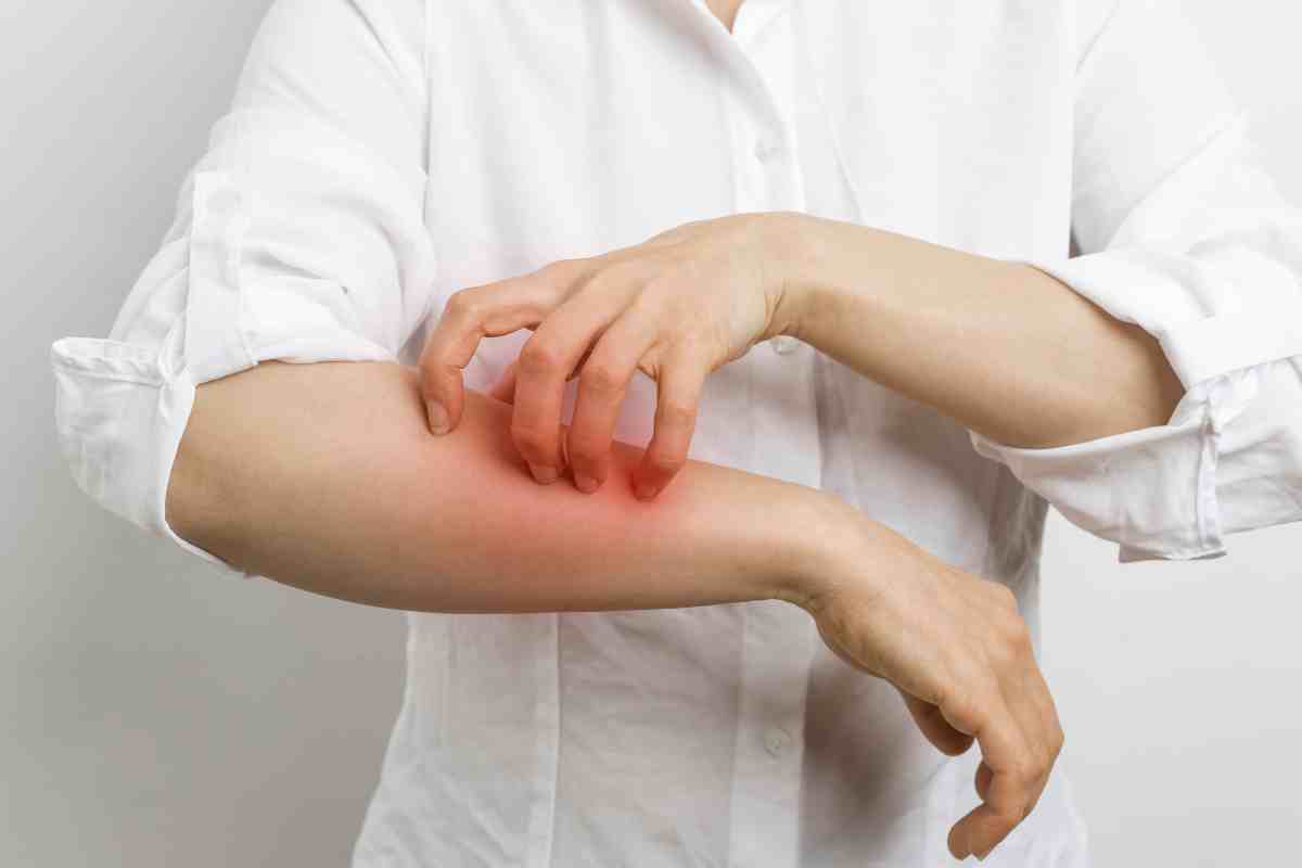 Allergia all'acqua: di cosa si tratta e quali conseguenze implica 1 All'allergia all'acqua: sintomi e trattamento