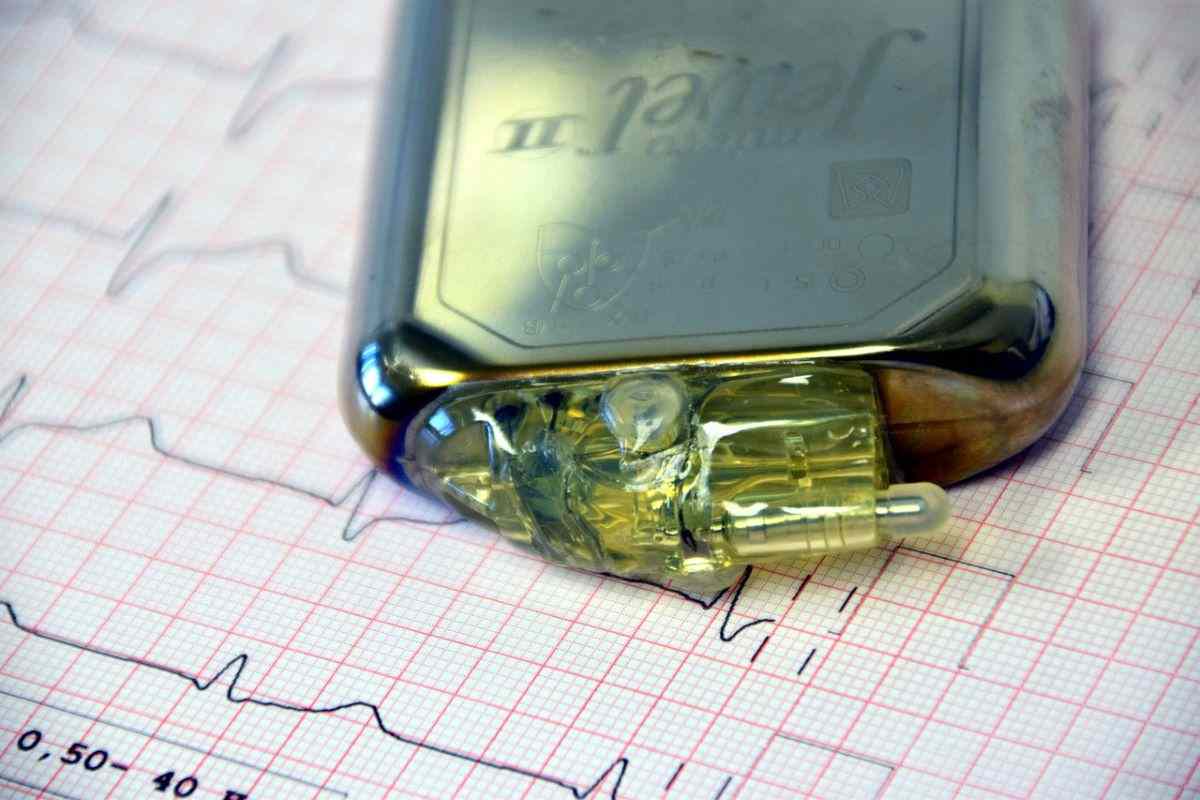 nuova tecnologia meglio del pacemaker potrebbe salvare tantissime vite