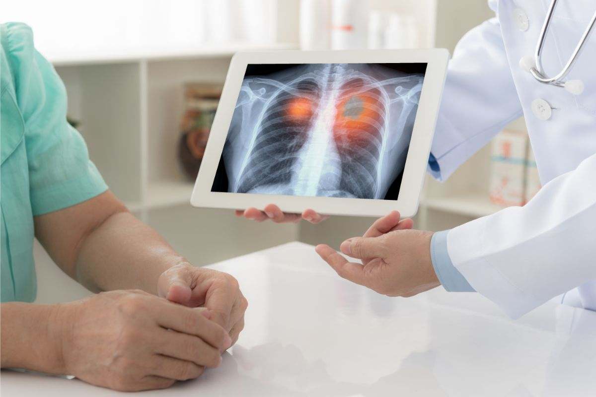 come si diagnostica il tumore ai polmoni