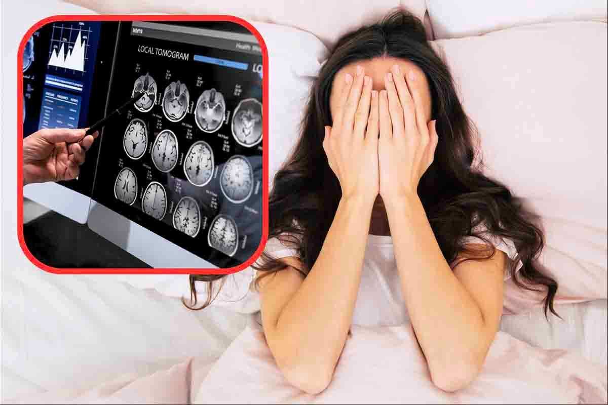 Cosa succede al cervello se dormi male di notte