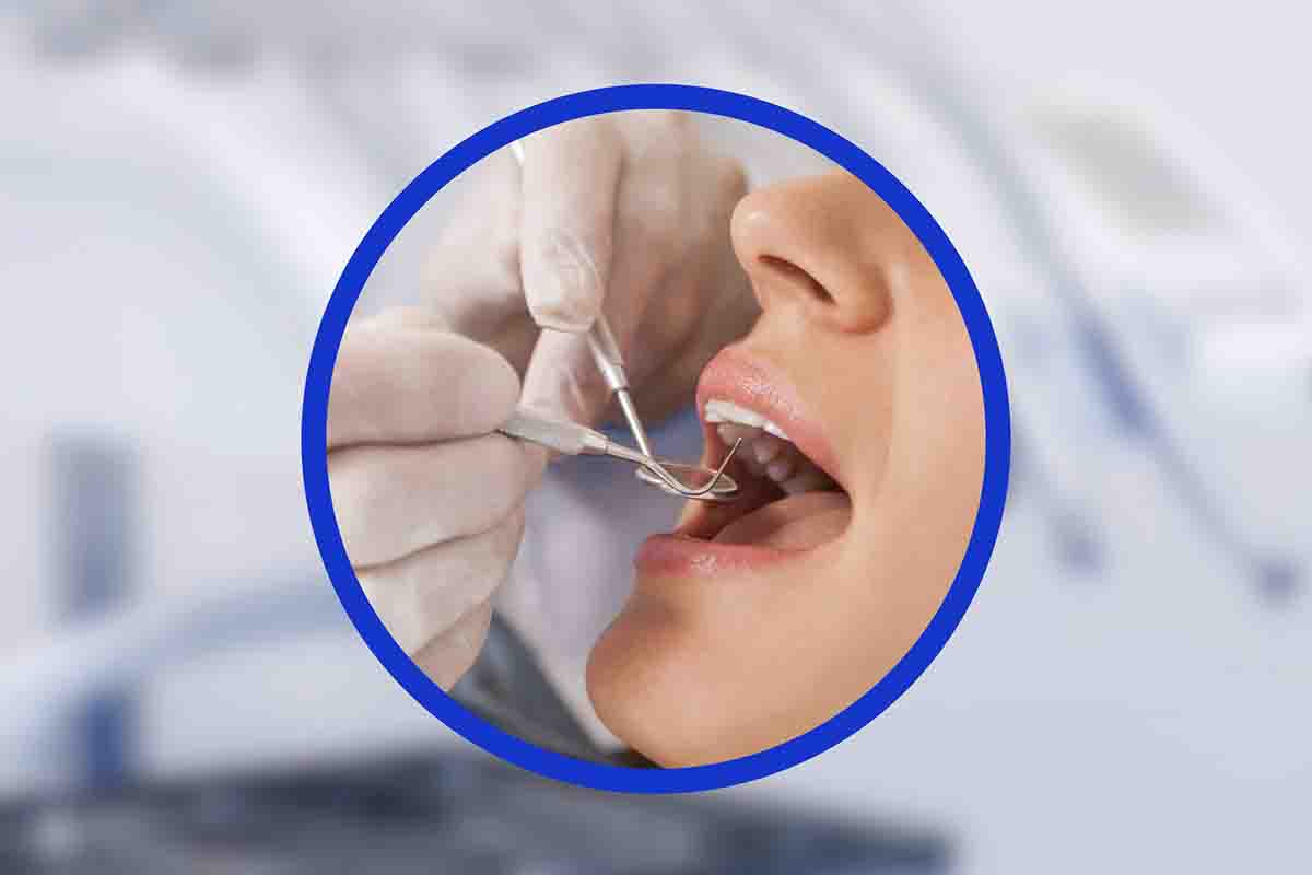 Come si lavano i denti: gli errori più comuni